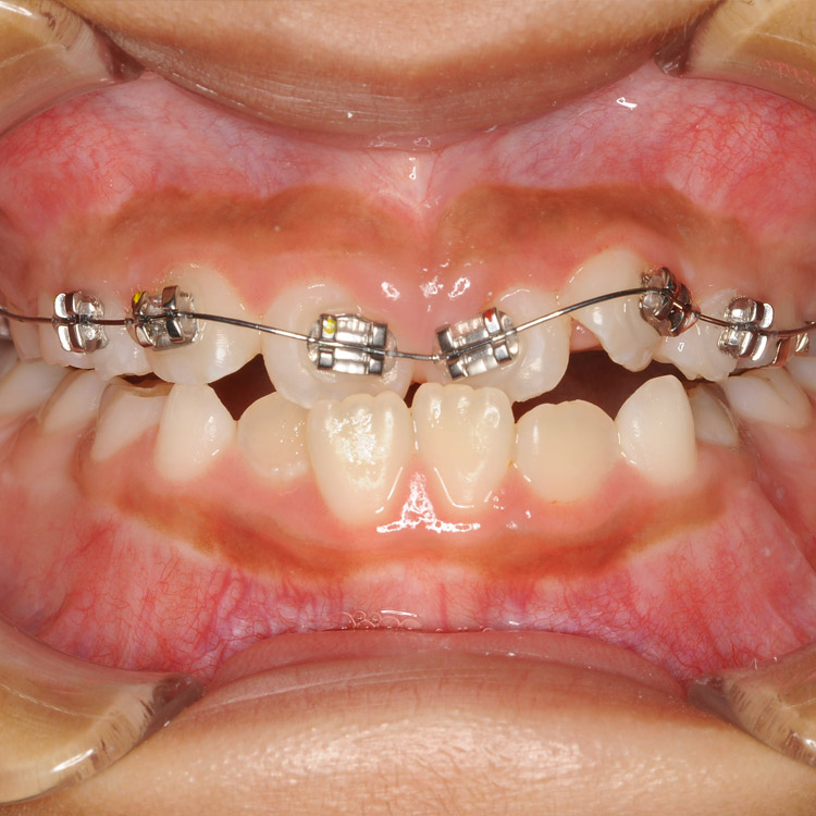 img medicalguidance orthodontic04