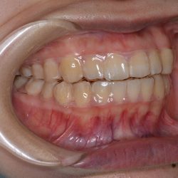 img_medicalguidance_orthodontic_flow06